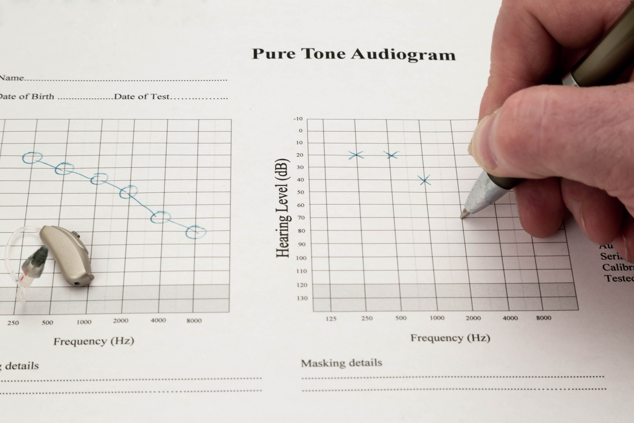 How Does Noise-Induced Hearing Loss Appear On An Audiogram?